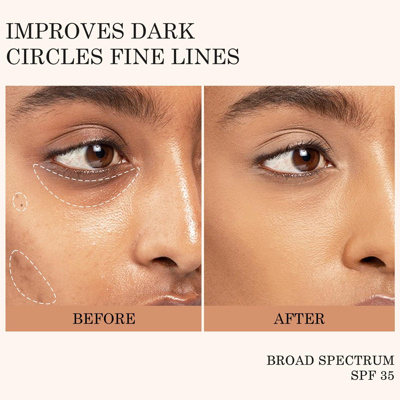 KYDA KYDA Mineral Sunscreen Eye Cream, SPF 35, 3-in-1 Under Eye Cream for Dark Circle and Fine Lines