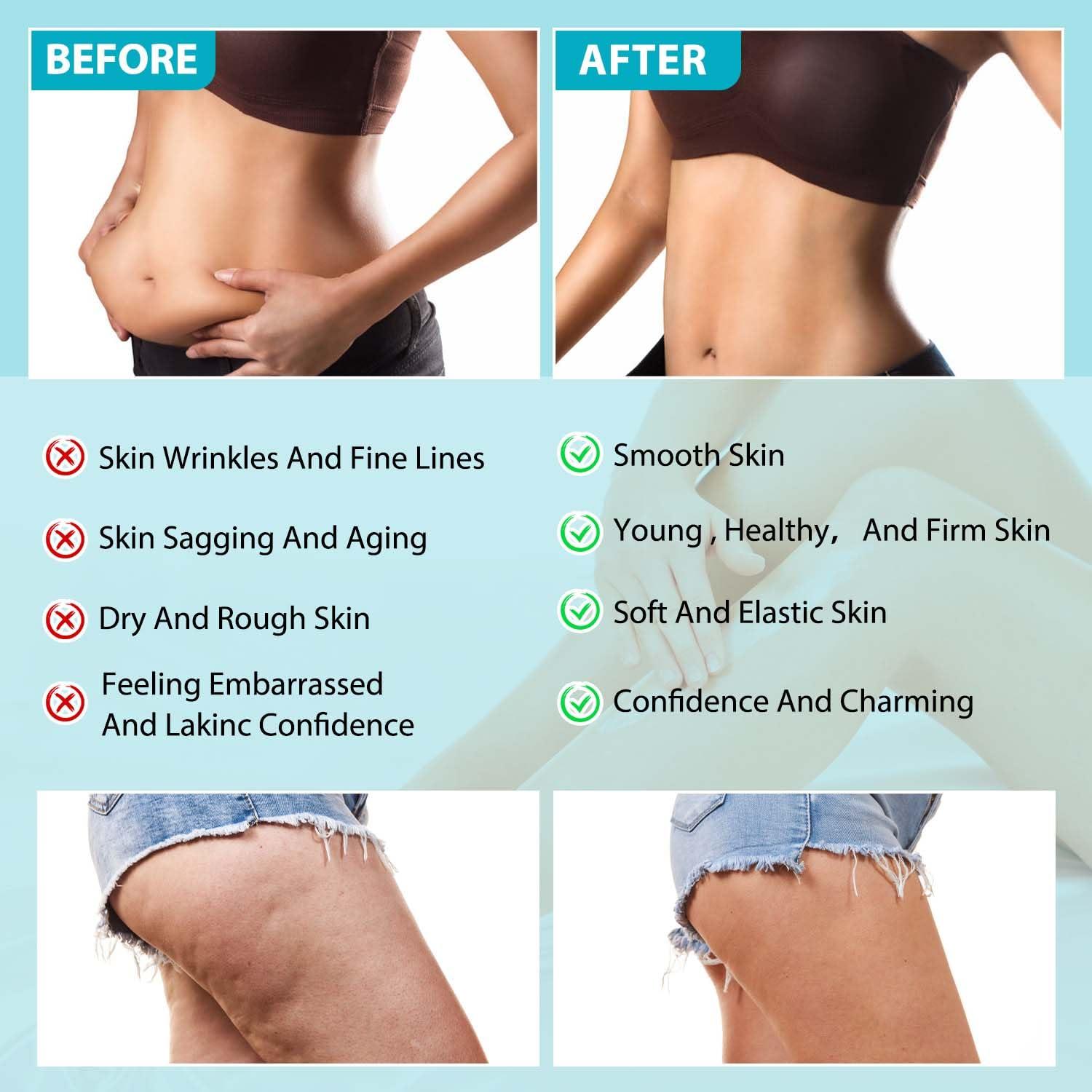 NUOKOU NUOKOU Luxelift Skin Firming Youth Butter, Luxelift Skin Firming Butter, firming body butter, Luxelift Skin Firming Butter, Moisturizes Skin and Improves Fine Lines (2 pcs)