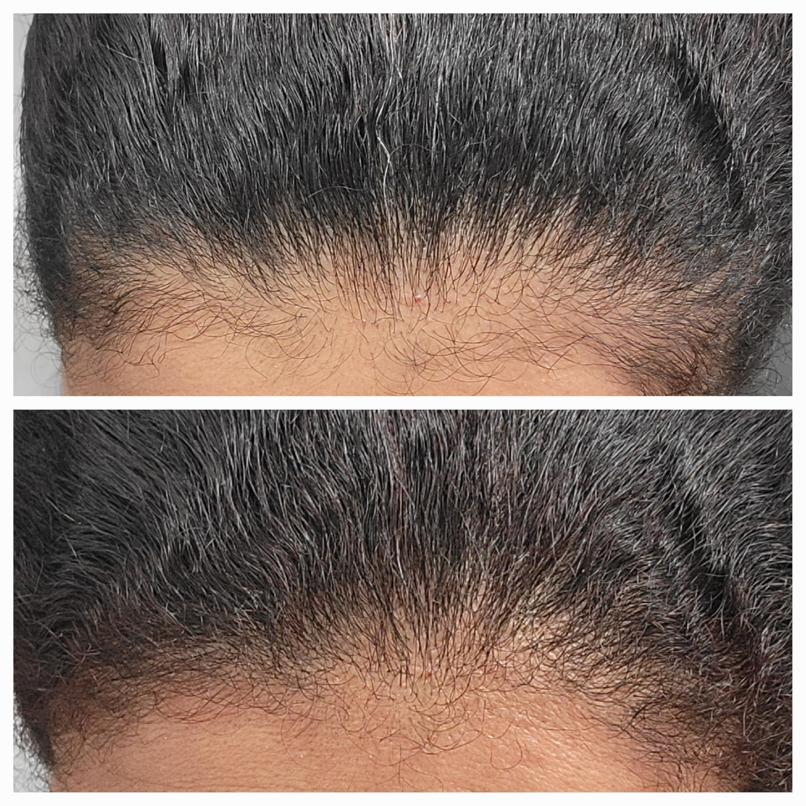 TRESSCURE TRESSCURE DHT Blocker Hair Growth Shampoo. Hair Regrowth Treatment for Men and Women.