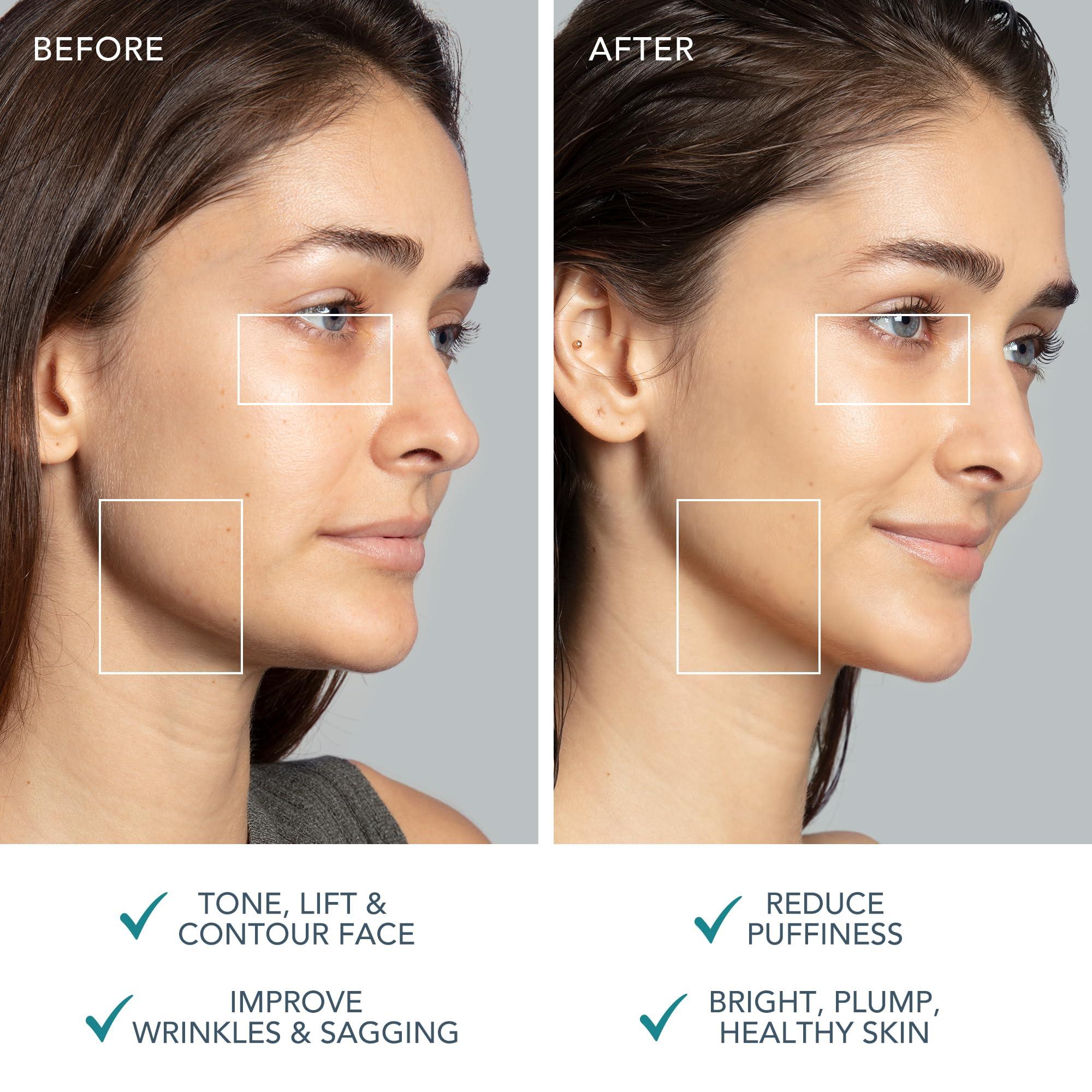 FOREO FOREO Bear 2 Advanced Lifting & Toning Microcurrent Facial Device - Anti Aging Face Sculpting Tool - Firm & Contour - Non-Invasive - Increases Skin Care Absorption - Evergreen