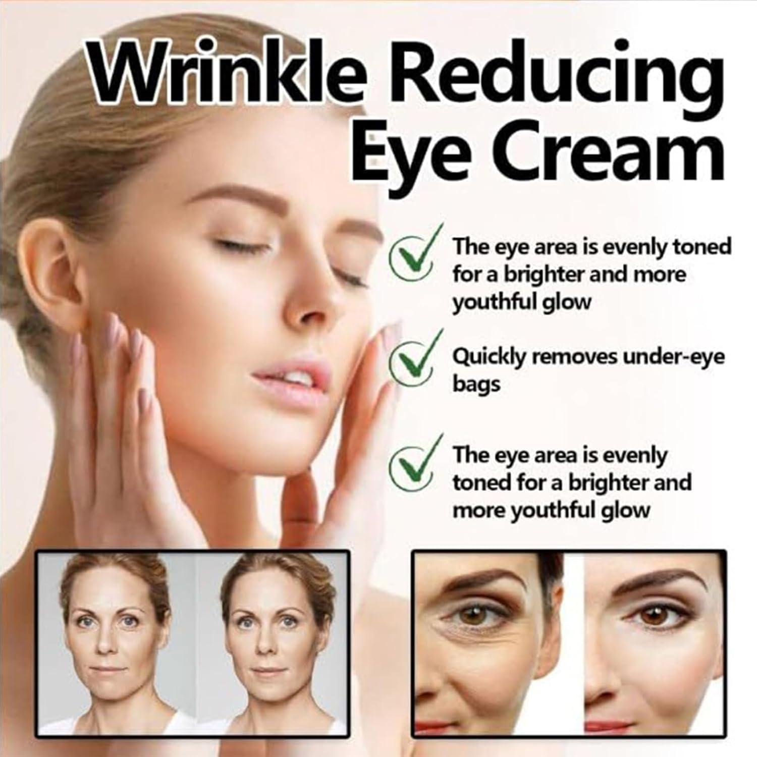 Kubot Harvey Ross Instant Lift Eye Cream, Harvey Ross effective Instant Eye Lift, Multi Action Firming Under Eye Cream, Under Eye Cream for Puffy Eye Bags Fine Lines, Specializes in Lifting The Eye Area