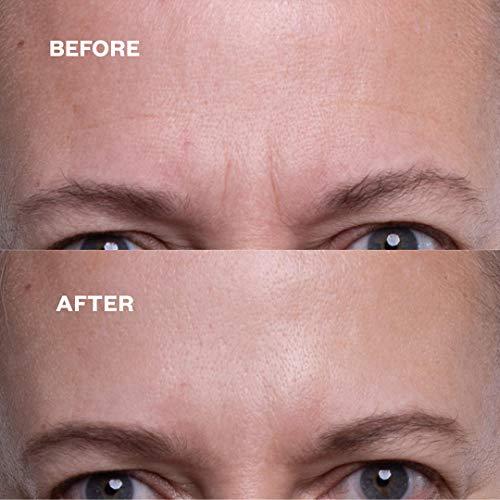 Wrinkles Schminkles Wrinkles Schminkles Faux-Tox Face Set: Silicone Patch Cleanser, Forehead Wrinkle Patches & Under Eye Wrinkle Patches