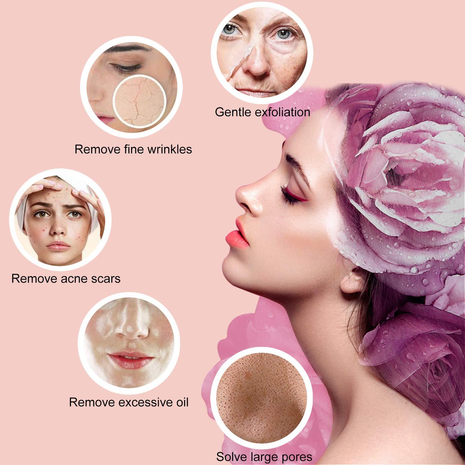 Yofuly Yofuly Diamond Microdermabrasion Machine, 65-68cmHg Suction Power Professional Dermabrasion, Home Use Facial Skin Care Equipment