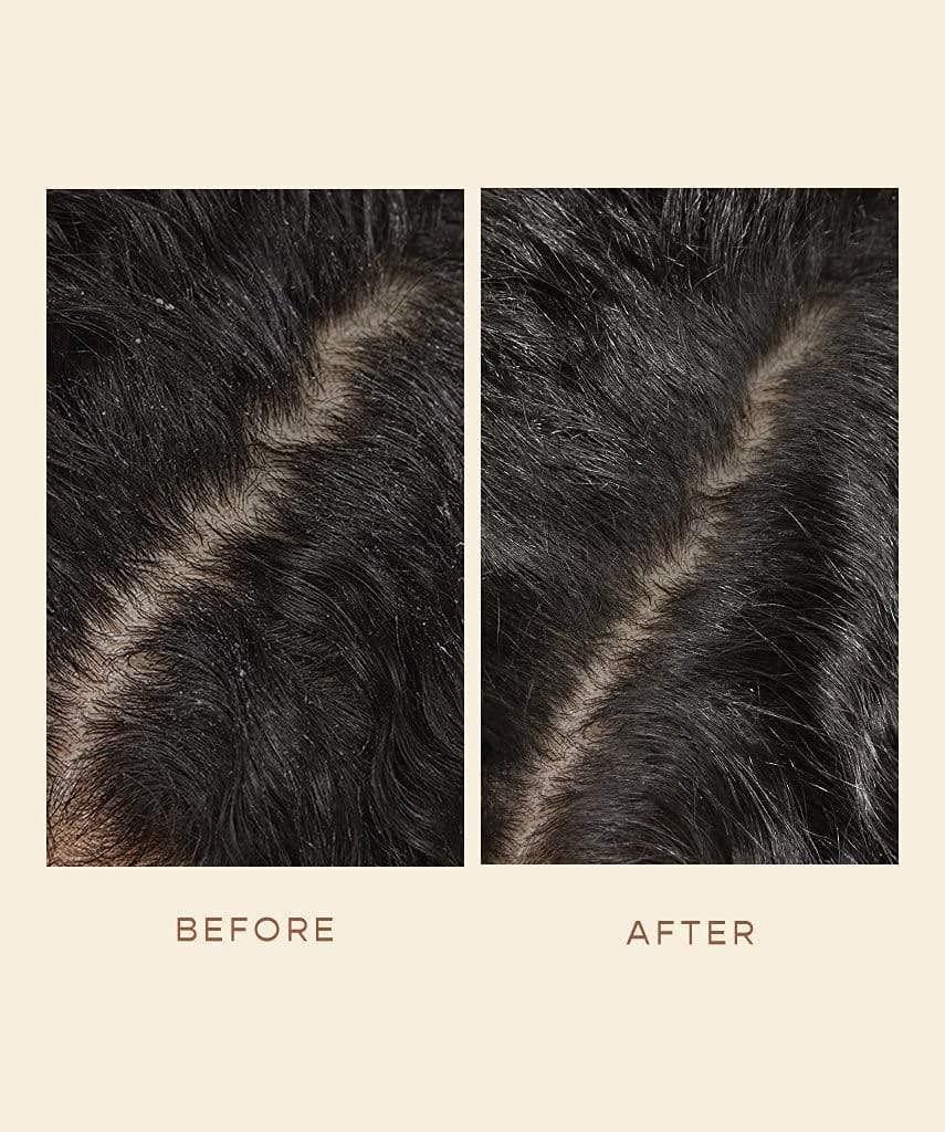 VEGAMOUR VEGAMOUR GRO Scalp Detoxifying Serum, Scalp Serum with Zinc PCA Removes Buildup & Soothes Scalp, Natural Citrus Scent, 2 fl. oz.