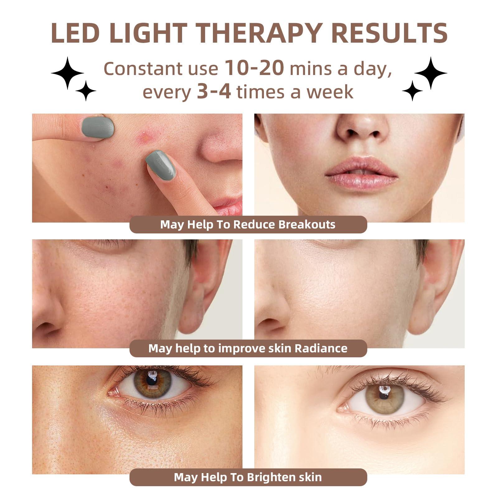 PAIM NRE LED Light Therapy Facial Mask, Multi Color LED Face Mask, Portable Red Light Therapy Mask, Home and Travel Skin Care