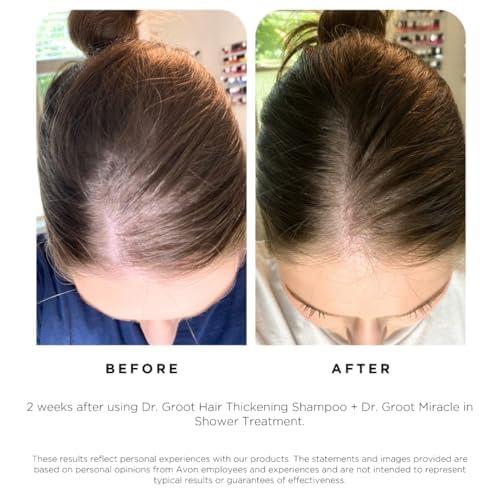Dr. Groot Dr. Groot Hair Thickening Shampoo, Korean Hair Care with Biotin, Rosemary Oil to help Volumize Thinning, Damaged Hair, Hydrate Hair and Scalp, Biotin Shampoo,Scalp Revitalizing Solution