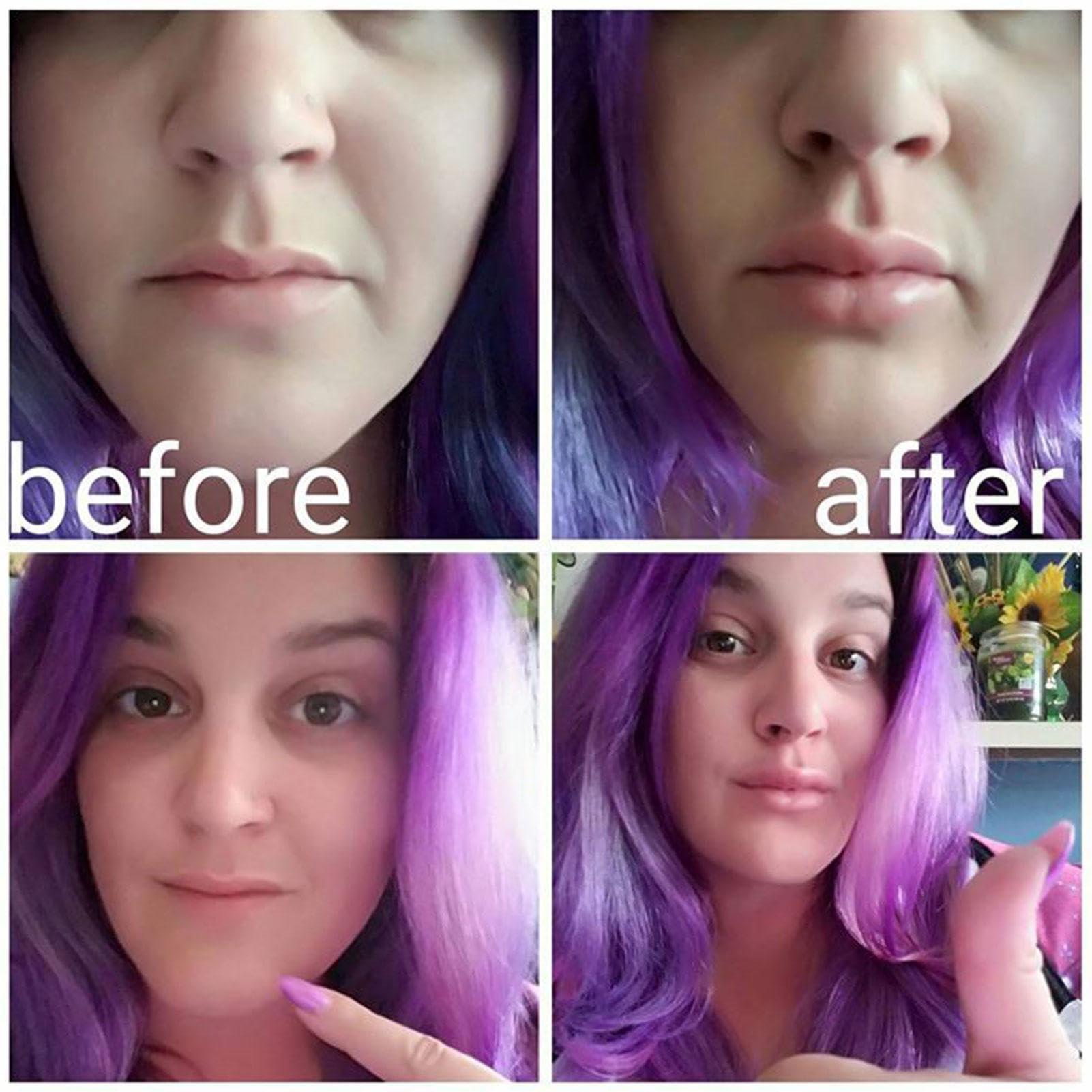 passi passi Lip Plumper Device | Fish Shape Lips Enhancer, Fish Lip Mouth Beauty Enhancer Device Fish Shape - Fuller Thicker Mouth Fastly Lip Pumps, Silicone Filler Plumper For Sexy Mouth, Natural Pout