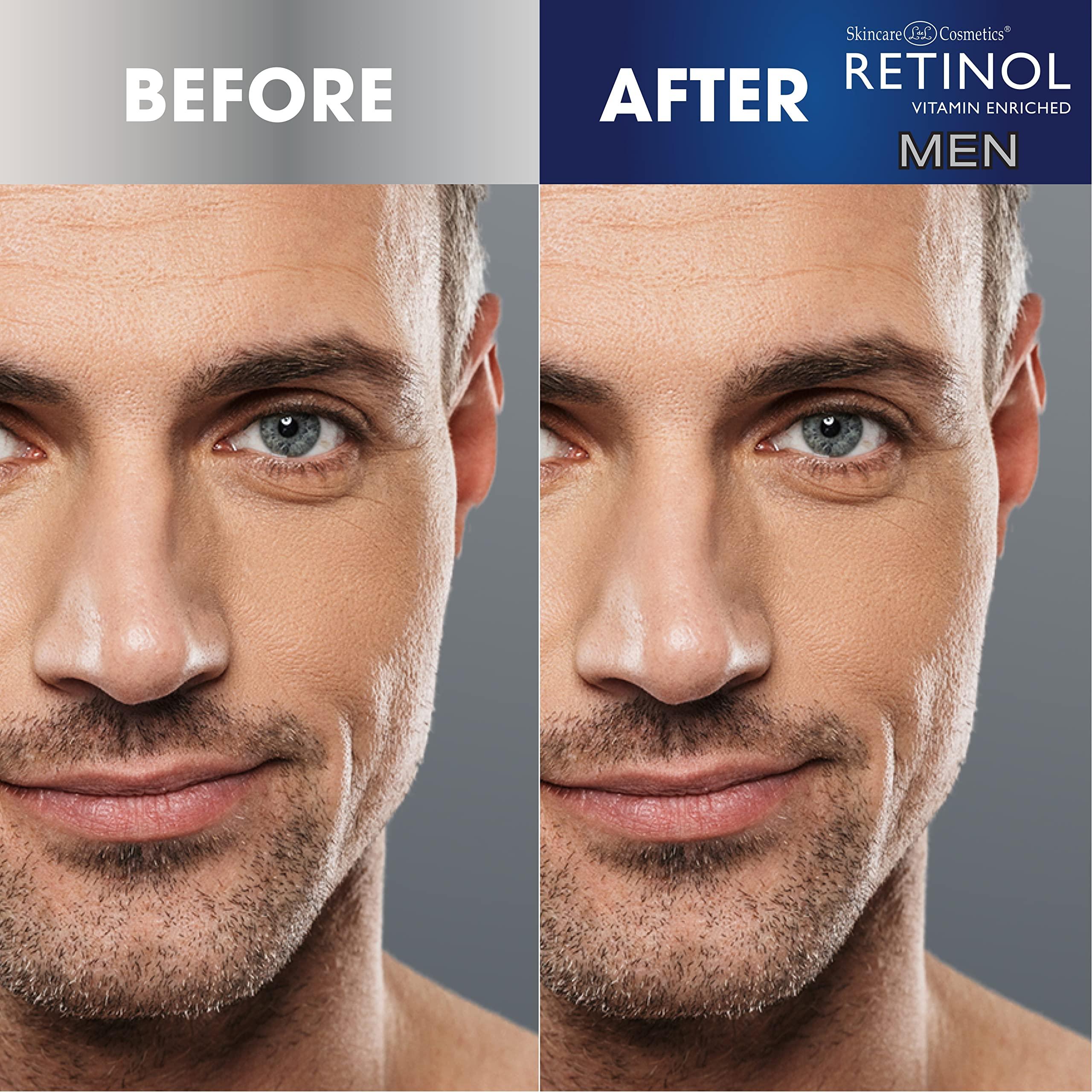 Retinol Retinol Mens Charcoal Blackhead Remover The Original Anti-Aging Peel-Off Cleansing Pore Strips Unclogs Pores & Lifts Out Deep-Down Dirt, Oil & Blackheads In Just 10 Minutes