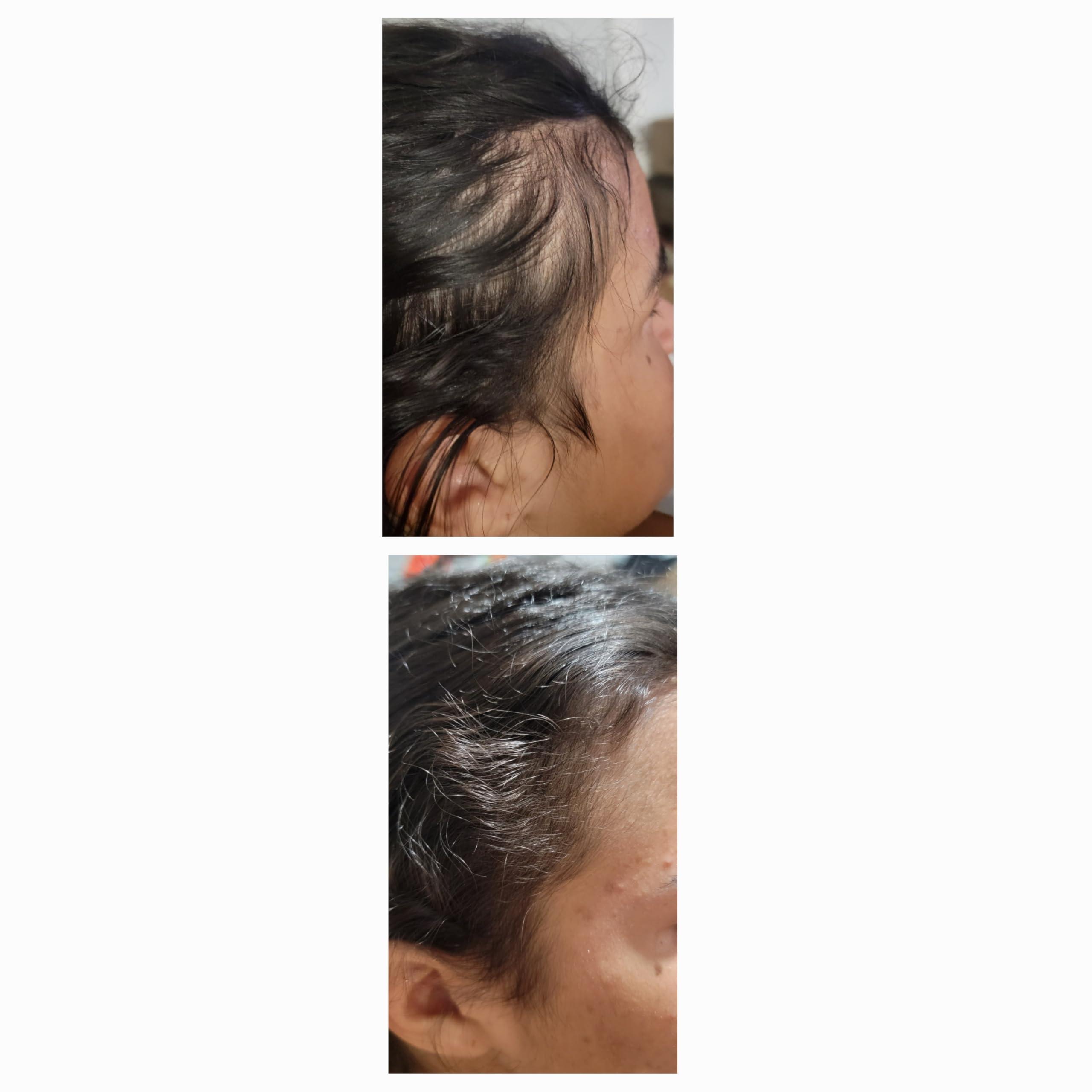 TRESSCURE TRESSCURE DHT Blocker Hair Growth Shampoo. Hair Regrowth Treatment for Men and Women.