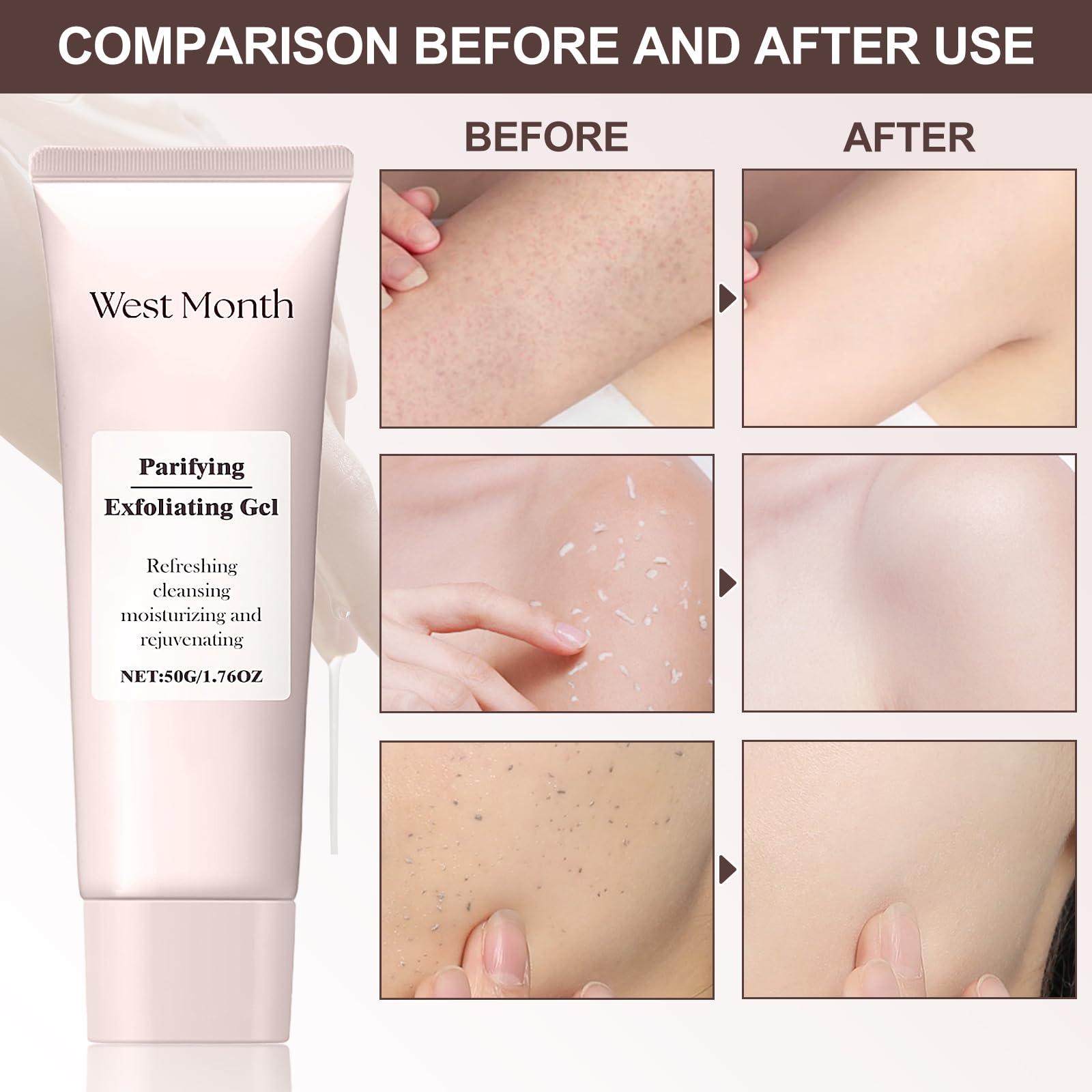 FAIRYTALESPACE Purifying Exfoliating Gel, Natural Exfoliating Gel Scrub for Face and Body Cleansing and Moisturizing (2PCS)