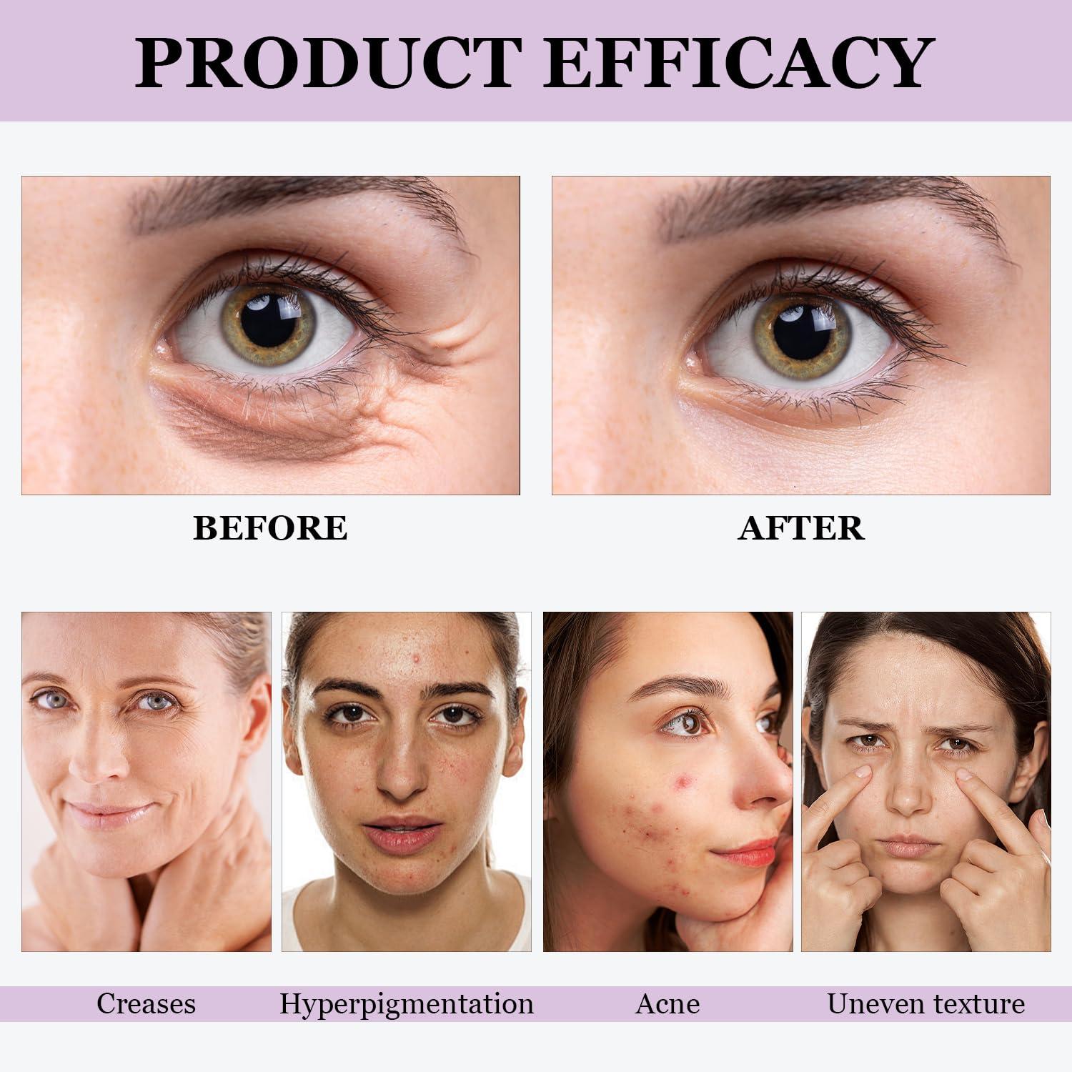 Iaolose 2 PCS Venature Bakuchiol Retinol Rejuvenation Serum, Bakuchiol Retinol Serum Korean for Face, Retinol Serum for Wrinkles, Reduce Wrinkles