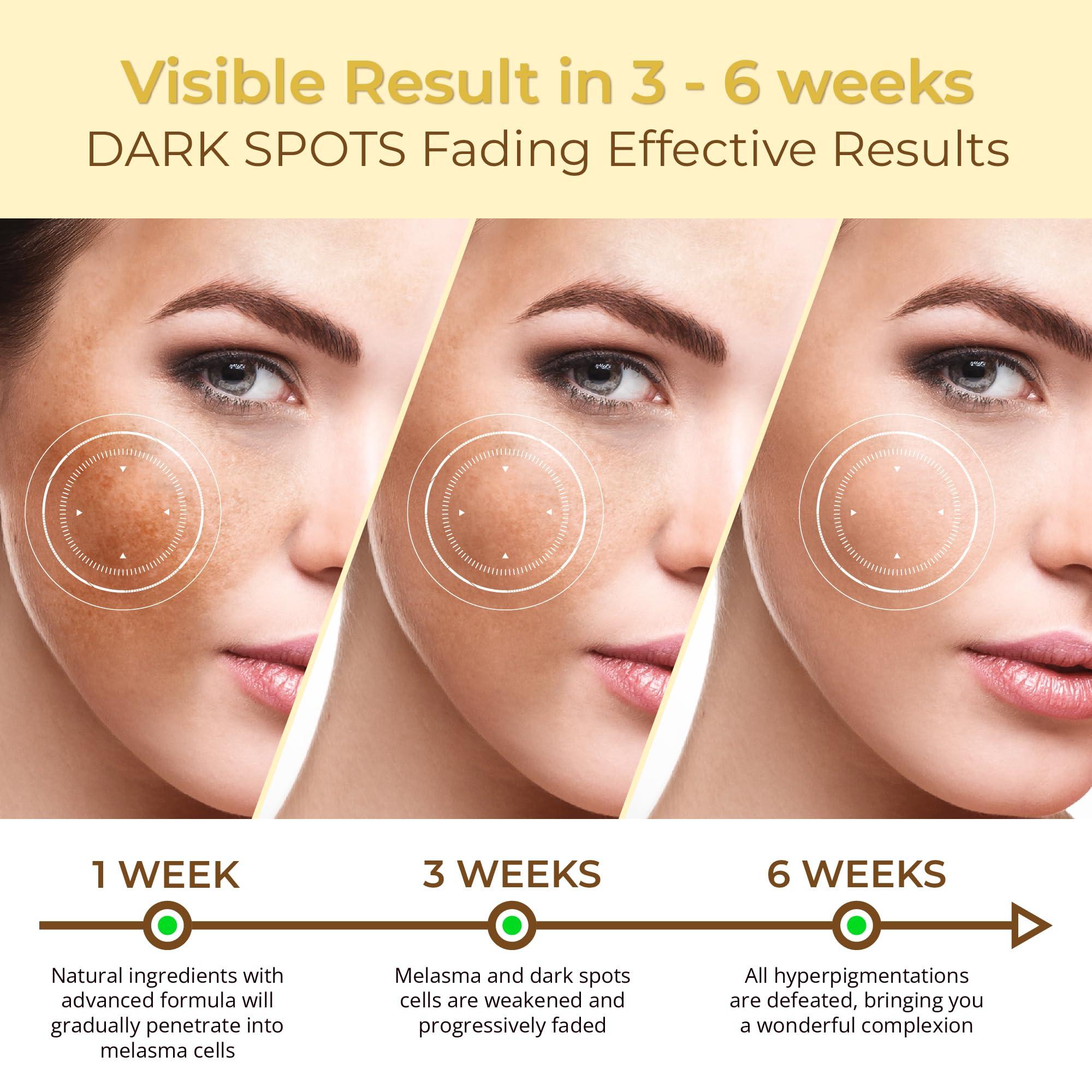 ABERA ABERA Tr Nm Kasumi, Kem M Tn Nhang, Dng Trng Da Cao Cp Nht Bn, Gim i Mi, Melasma Treatment For Face (0.7 Oz Per Item)