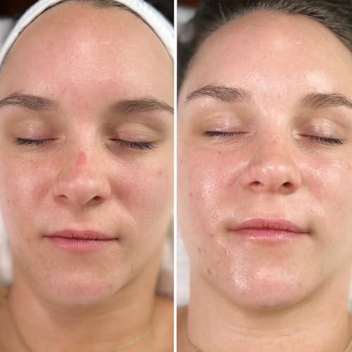 Intraceuticals Intraceuticals Vitamin B+3 Booster