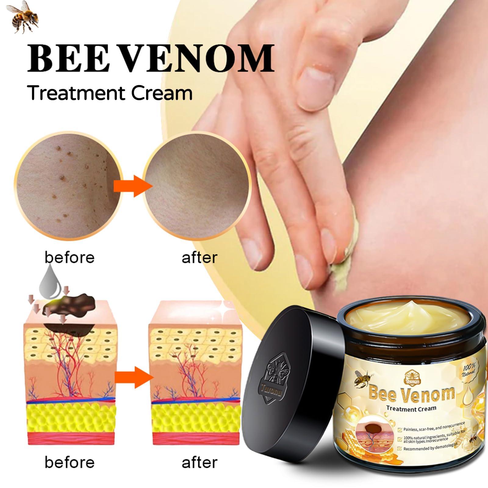 AEEHFENG Turanu Bee Venom Skin Treatment Cream, 2024 New Bee Venom Repair Cream, Turanu Professional Bee Venom Cream, Repair Maximum Strength for All Skin Types (3 Bottle)