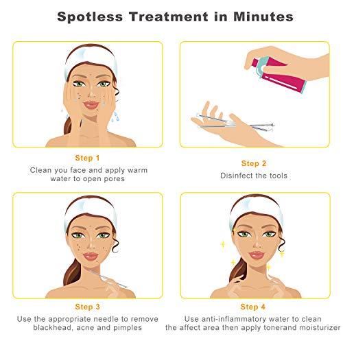 Boxoyx Pimple Popper Tool Kit - Boxoyx 10 Pcs Blackhead Remover Comedone Extractor Kit with Box for Quick and Easy Removal of Pimples, Blackheads, Zit Removing, Forehead,Facial and Nose (Black)