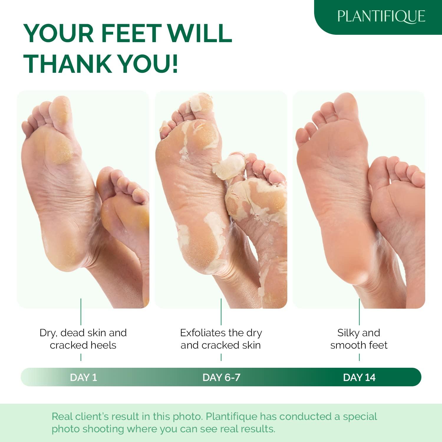 PLANTIFIQUE PLANTIFIQUE Foot Peeling Mask for Men 2 pack and Gold Under Eye Patches for Puffy Eyes and Dark Circles 20 Pairs