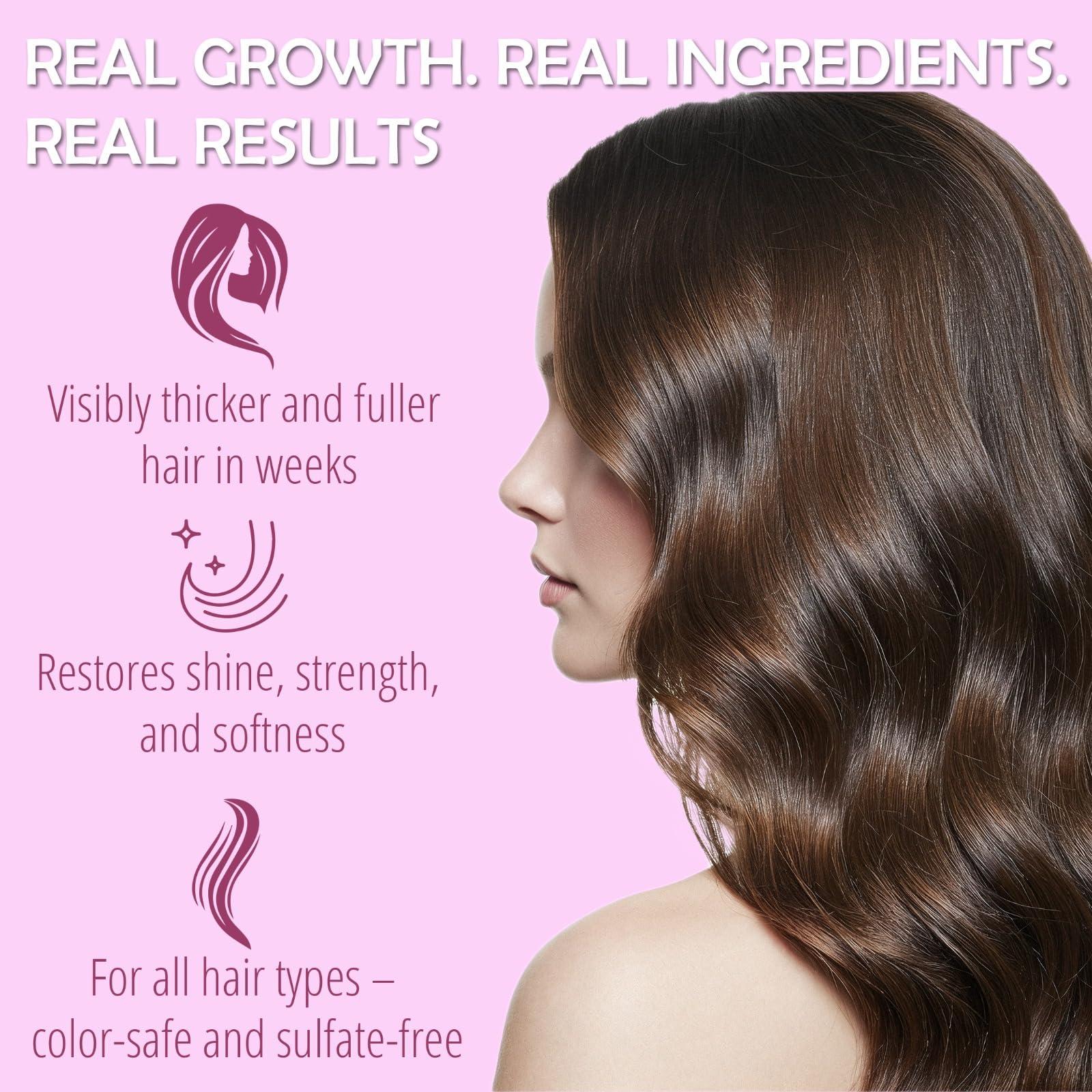 Generic Onion Shampoo for Hair Growth Sulfate-Free, Paraben-Free, Silicone-Free Stimulates Faster Hair Growth, Reduces Hair Loss, Deep Cleans Scalp, 500ml, Ideal for All Hair Types, No Onion Smell