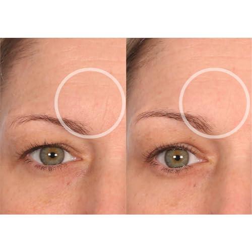 SiO SiO Beauty FaceLift - Reusable Anti-Wrinkle Patches for Neck, Forehead, Eye & Smile - Overnight Smoothing Silicone for Fine Lines, Wrinkles, and Aging