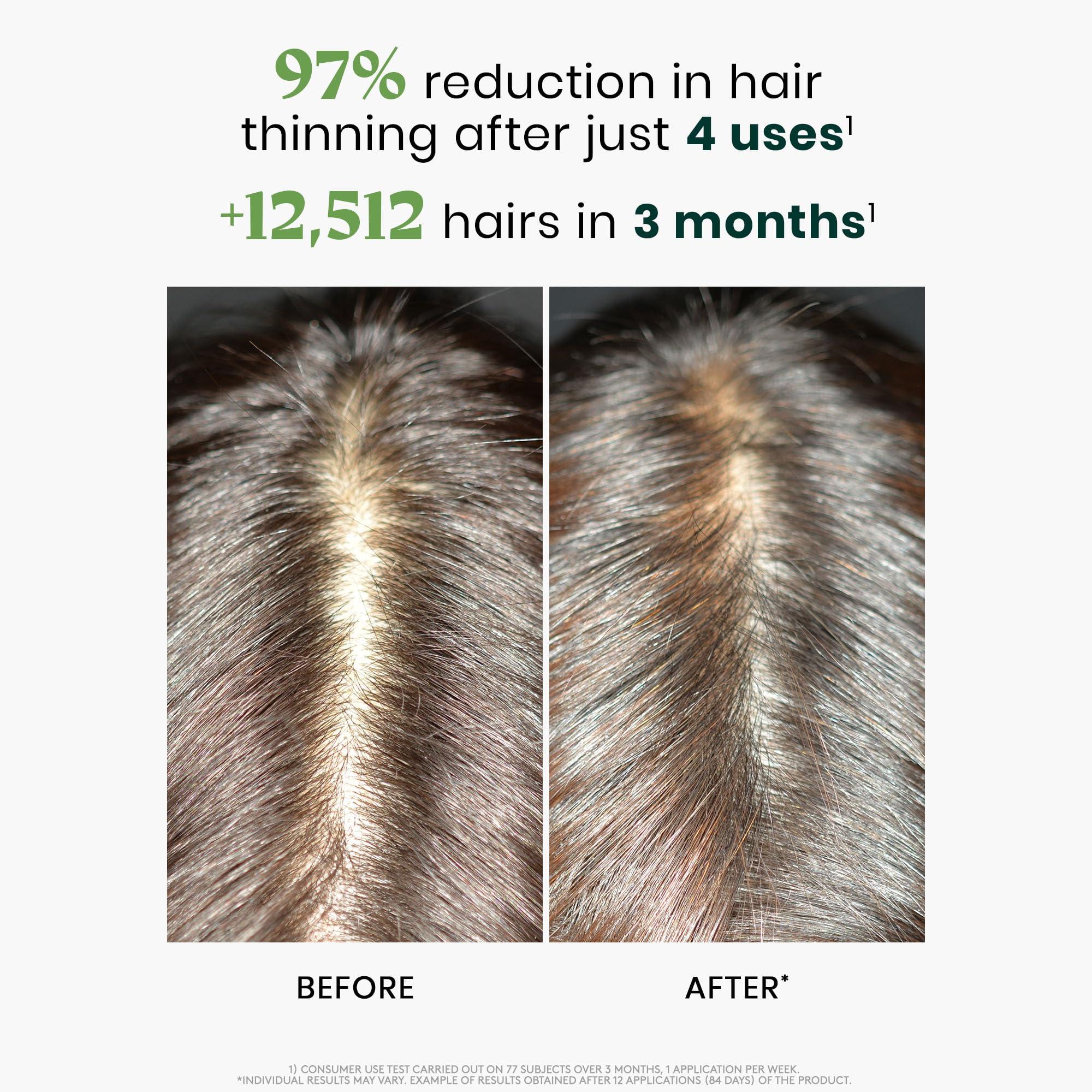 Ren Furterer Rene Furterer TRIPHASIC Reactional Concentrated Serum - For Sudden Thinning Hair - Postpartum, Stress - Drug-Free - 12 ct., 3-Month Supply