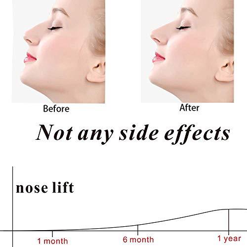 Meservice Nose Shaper Clip Nose Beauty Up Lifting Silicone Pain-Free Nose Bridge Straightener Corrector Slimming Rhinoplasty Device for Wide Crooked Nose High Up Tool