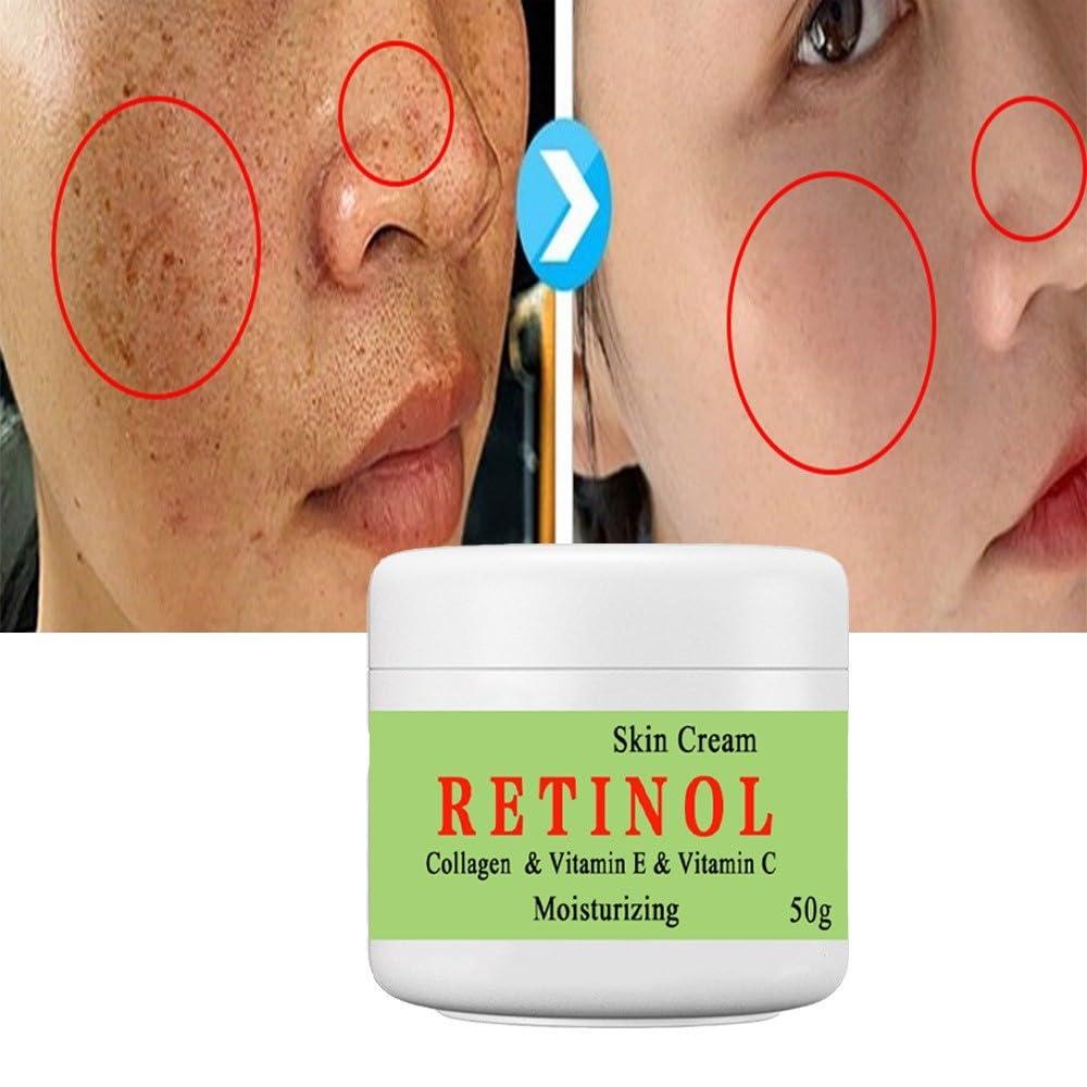 BEROZA BEROZA Cremas Para Las Manchas de La Cara, 50g Vitamin C&E Face Moisturizer Cream, Adecuado para varias reas como cara, axilas, cuello, zona privade (3pcs)