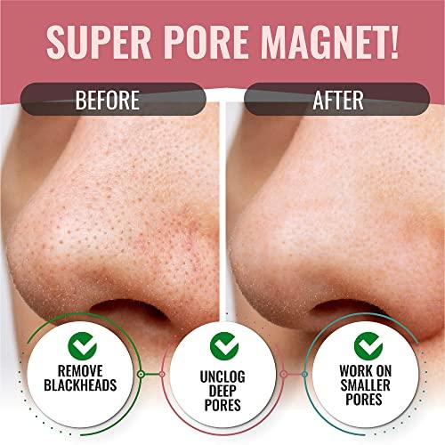 LOOKATME LOOKATME Nose Pore Strips (4-Pack, 20 Nose Strips). Korean Skin Care Blackhead Remover. K Beauty Blackhead Strips for Nose and Face, Black Head Strips Women. Acne Mask for Blackhead Removal. (Combo)