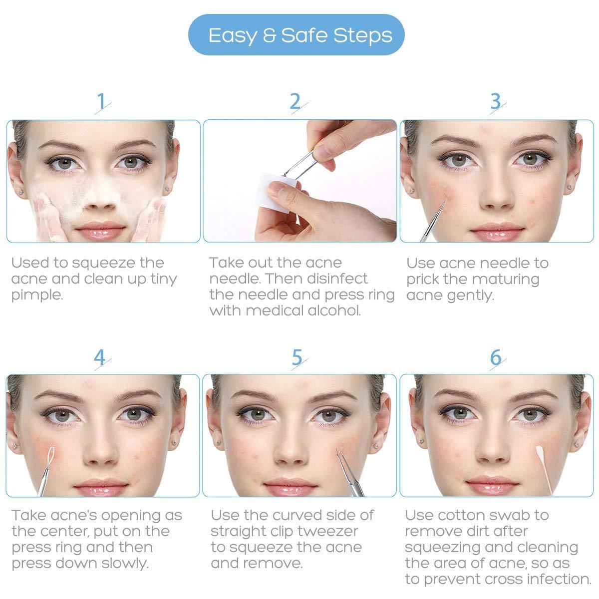 FEITA Blackhead Remover Kit - FEITA Blackhead Tweezers Removal Tool Kit Set - Acne Tweezers Pimple Comedone Extractor With Travel Case (5 Pcs)