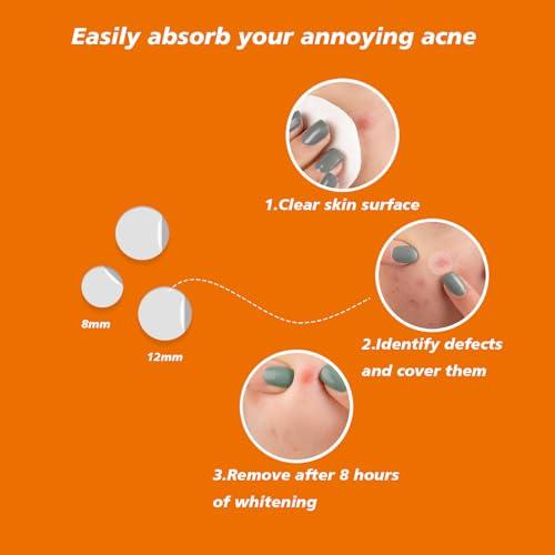 Leoezx Leoezx Acne Pimple Patches 72 Pcs,Acne Spot Dots,Facial Acne Patch,Hydrocolloid Acne Patch for Face,All Skin TypesAcne Patch & Pimple Patch