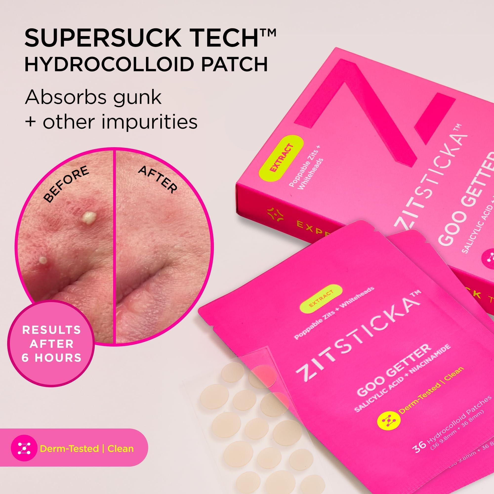 ZitSticka ZitSticka Pimple Patches for Face and Body, Hydrocolloid Patches to Cover Zits, Acne Patches or Zit Spot Stickers, Body Patch (GOO GETTER 36 Pack)