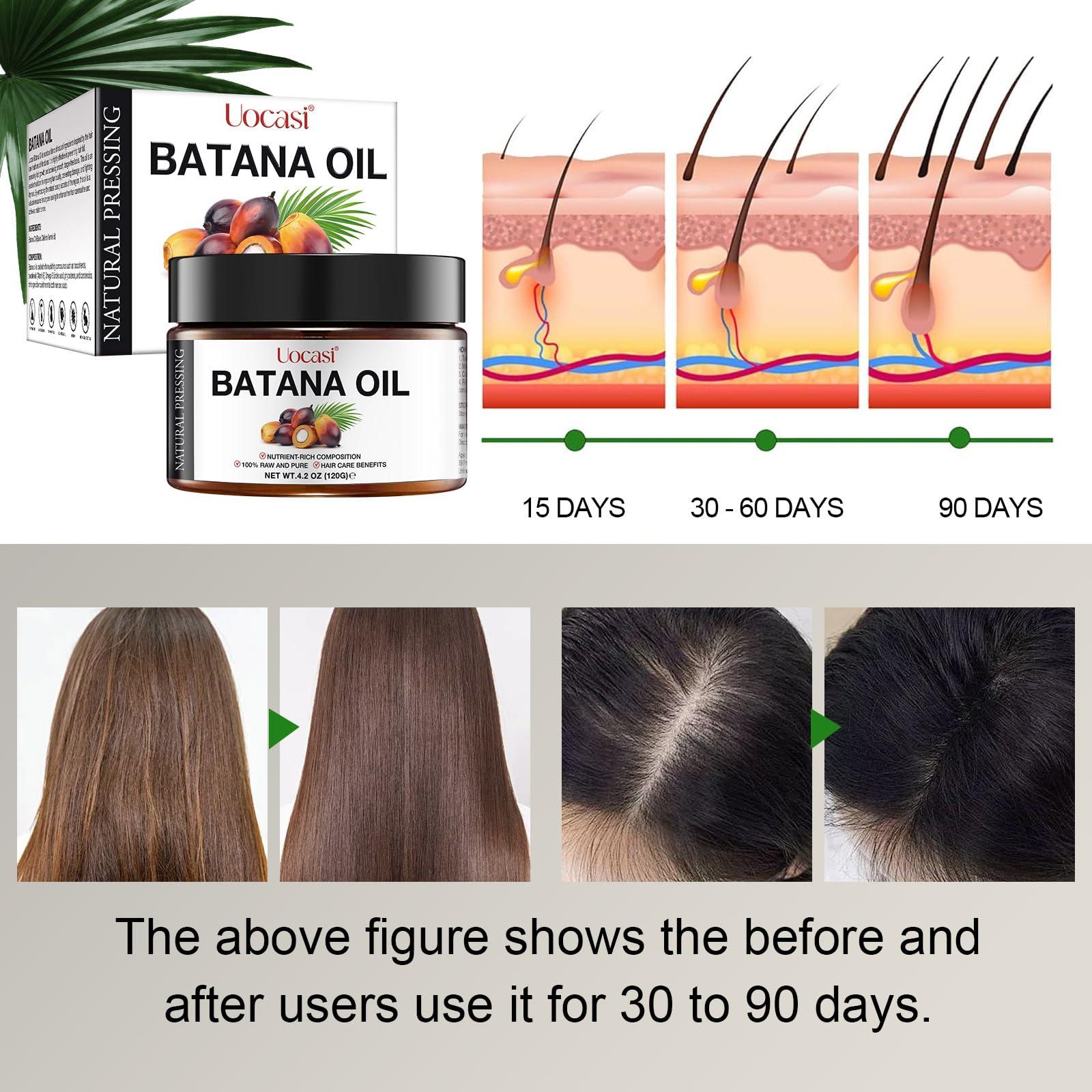 A r b c r n Raw Batana Oil for Hair Growth (4.2 OZ), 100% Pure Natural Unrefined - Prevent Hair Loss and Promotes thickness for Women & Men
