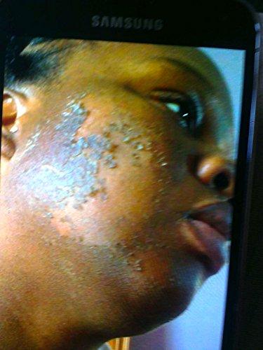 Herbal Power Peel Herbal Power Peel- Chemical & Acid Free Green Herbal Deep Sea Peel-Professional or Home Use