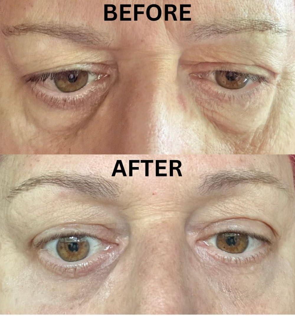 Generic Instant Eye Bag Puffiness And Wrinkle Remover Cream For Women And Men Made In The USA! Cruelty-Free