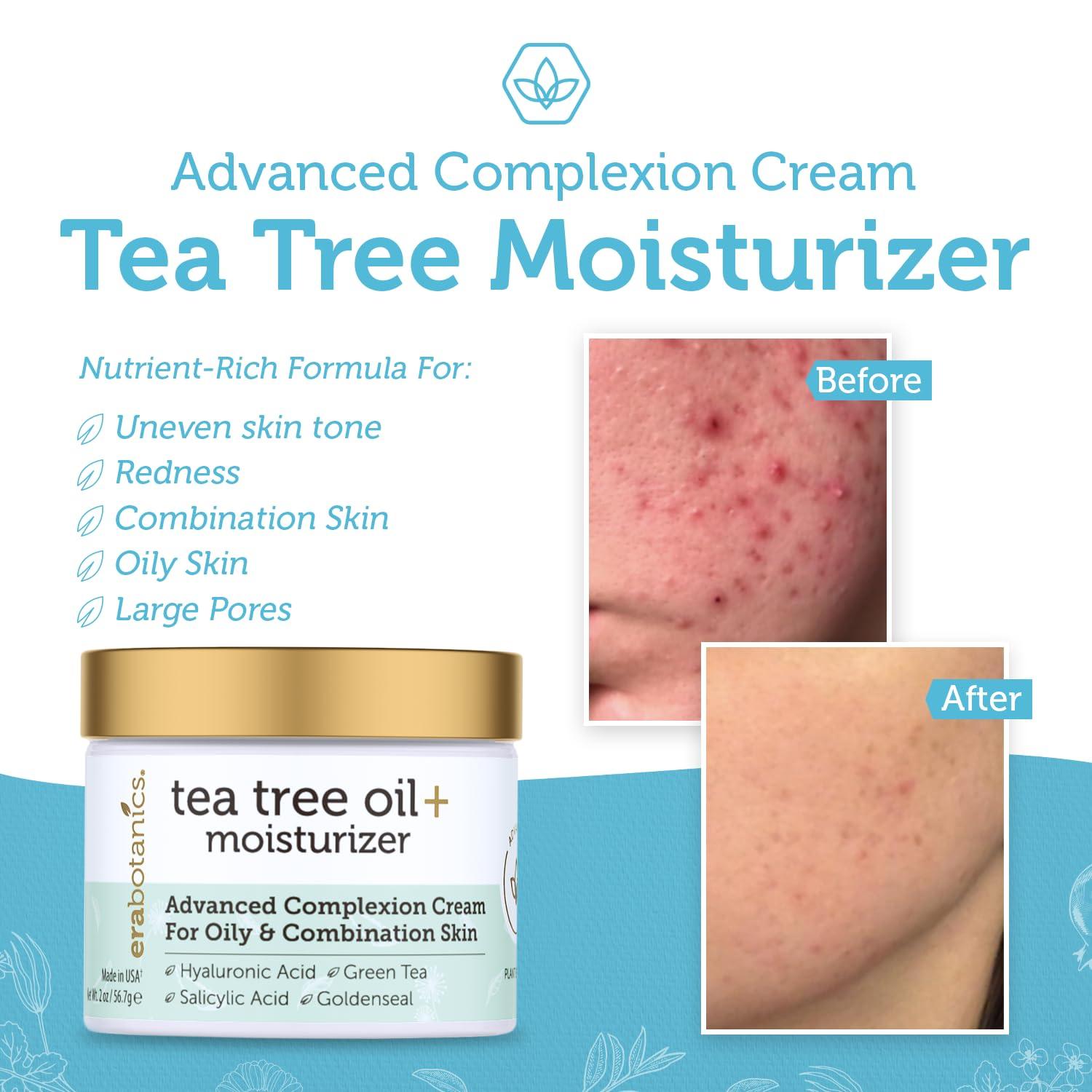 Era Organics Era Organics Tea Tree Cream Face Moisturizer for Oily Skin - Advanced 7X Balancing Oily Skin Moisturizer - Non-Greasy Moisturizer - Tea Tree Oil for Skin