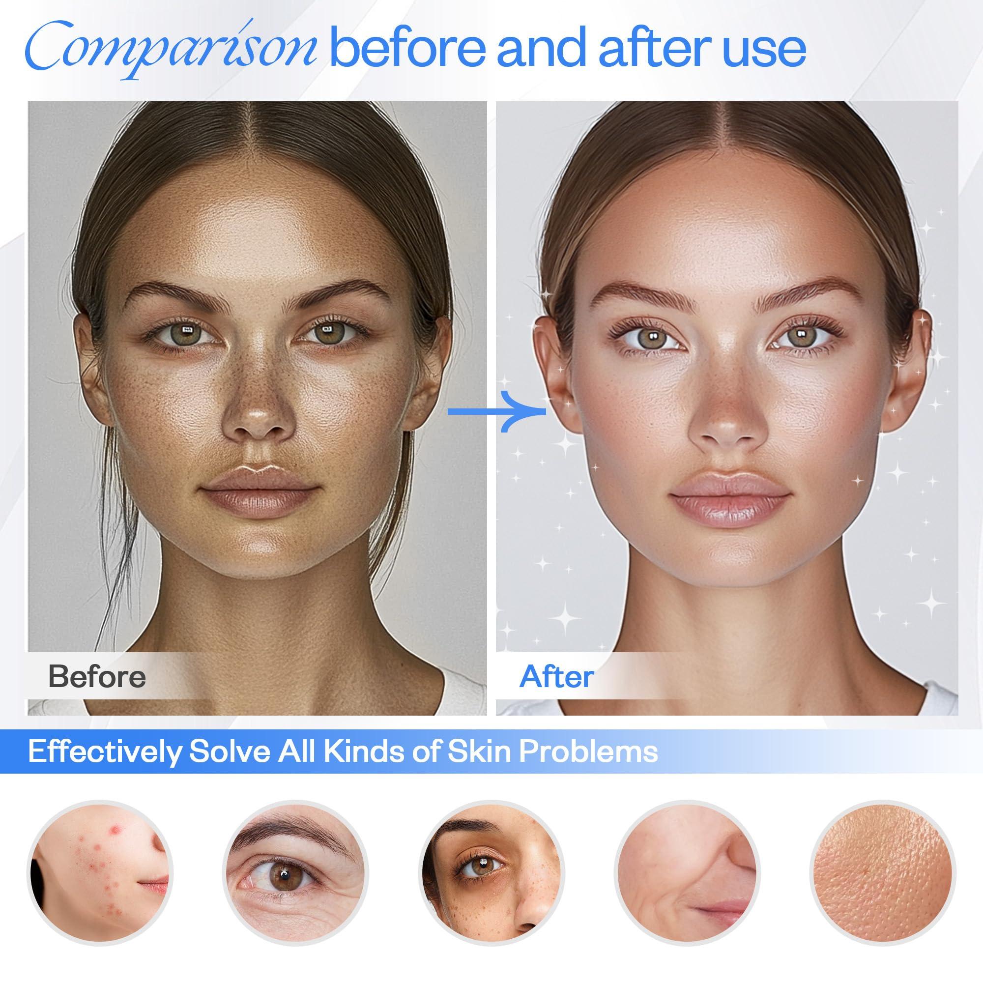 LuxReyan Blue Red Light Therapy Mask for Face, Red + Infrared Light Therapy Mask for Face, 4 Modes LED Face Mask Skincare at Home, Grey