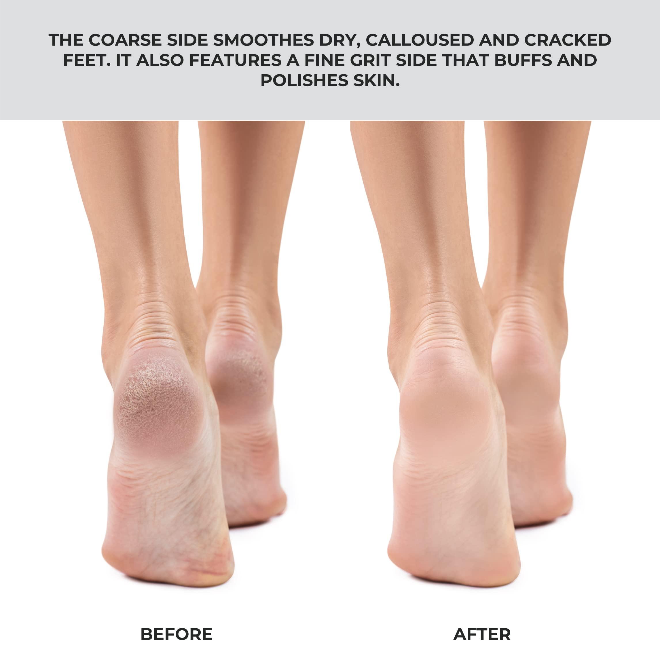 ForPro Professional Collection ForPro Pro Fusion Stainless Steel Pedi File - Coarse, Double-Sided Professional Quality - Blue Handle Pedicure File for Heels and Feet - 8.25” L