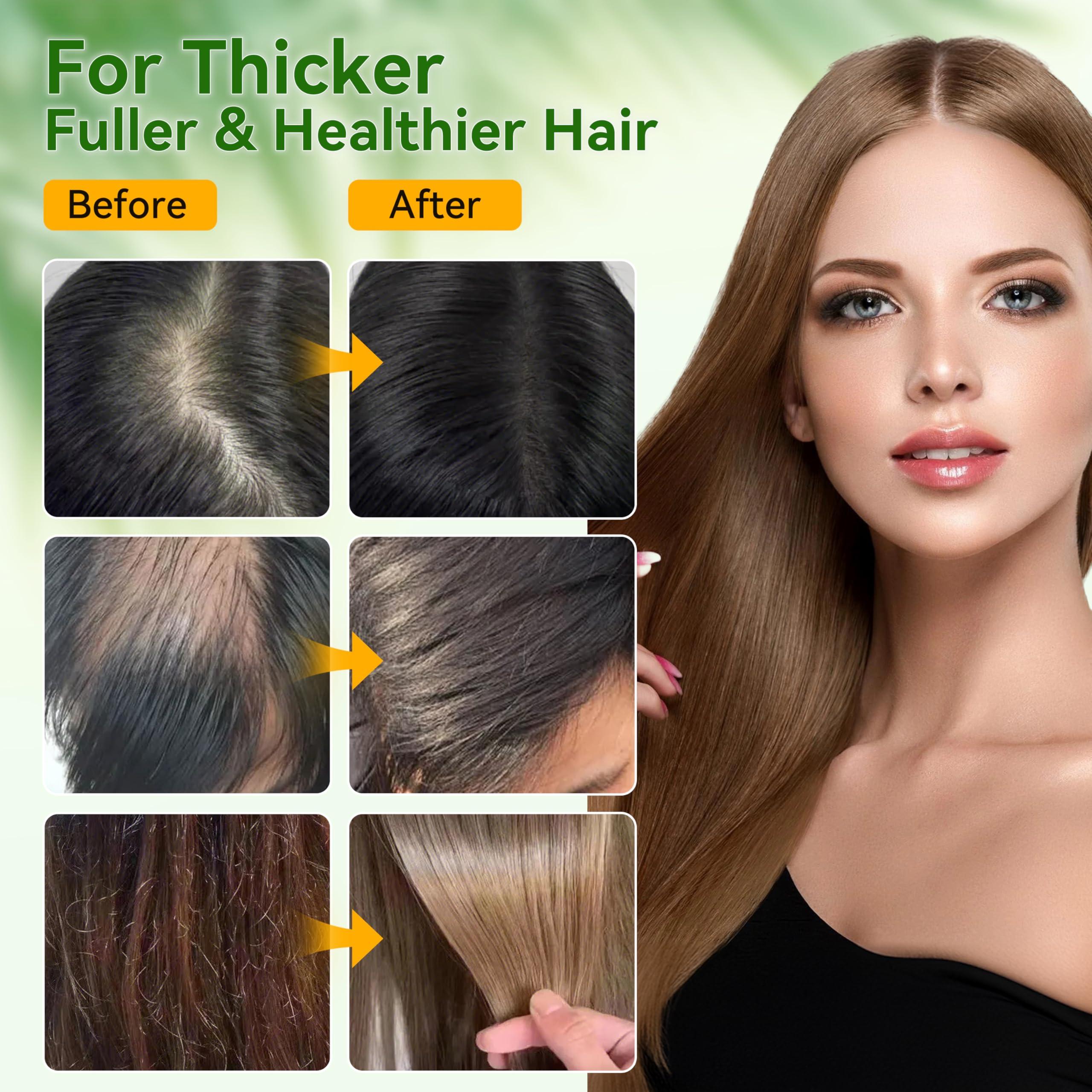 Veakoo Raw Batana Oil for Hair Growth, 100% Natural Pure, Dr. Sebi Organic Batana Oil from Honduras, Unrefined Hair Growth Oil for Women Men, Prevent Hair Loss, Repair Damaged Hair, Nourish Scalp 5.3 oz