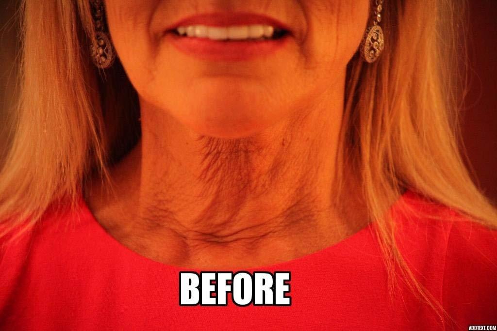 NeckTITE Magic NeckTITE Magic Instant Neck Lift, 12 Count - Smooths Wrinkles for Adults