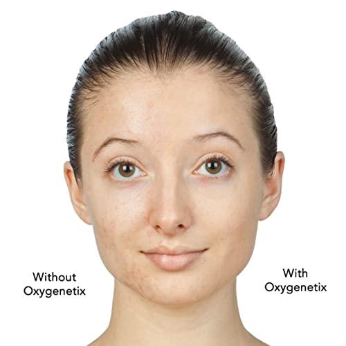 Oxygenetix Oxygenetix Oxygenating Foundation - 15ml - Ivory