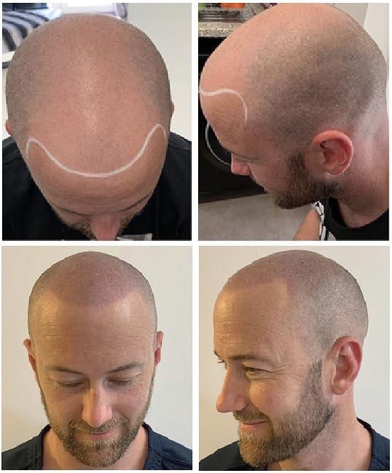 Nuva Colors Nuva Scalp Micro-Pigmentation Ink - Customizable, Neutral Undertone for SMP Procedures, Vegan, Made in USA (Dark Brown)