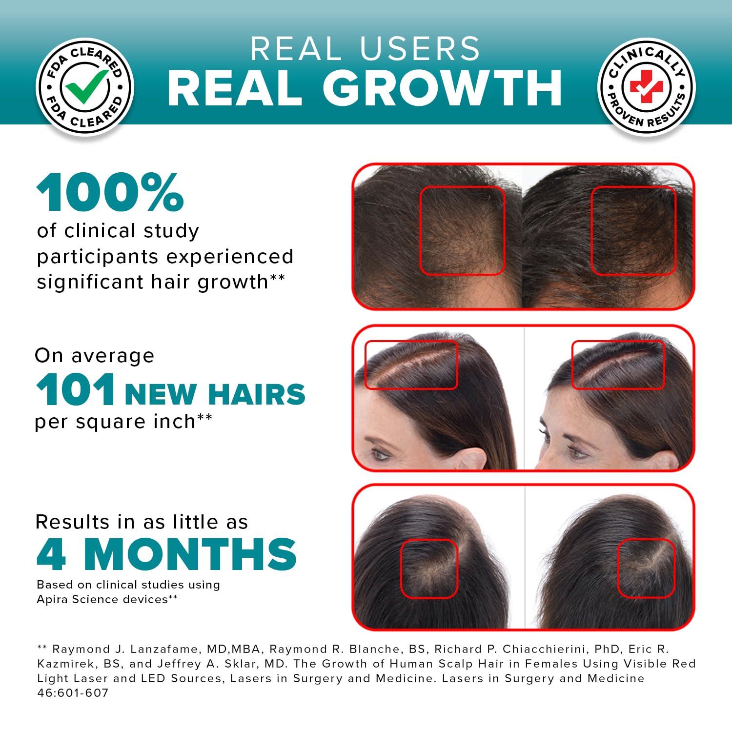 iGrow iGrow Laser Hair Growth System - Clinically proven, FDA Cleared Laser Cap Hair Growth for Men & Women.