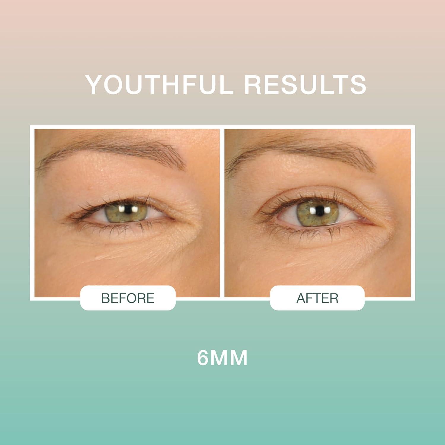 Contours RX Contours Rx Lids by Design - Medical Grade Instant Eyelid Correcting Strips for Heavy, Hooded, & Droopy Lids - Invisible, and Hypoallergenic Eyelid Tape - (6mm) 160ct