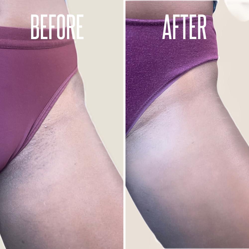 Divine Derriere Intimate Skin Lightening Gel for Body and Bikini Area & Ingrown Hair Eliminator Serum Provides the Most Effective Combination For Fading Dark Spots & Removing Ingrown Hairs