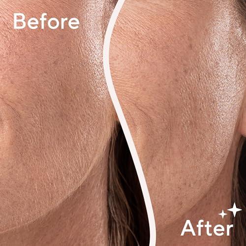 Finishing Touch Flawless Finishing Touch Flawless Dermaplane Glo Sonic Lighted Facial Exfoliator, Electric Vibrating Dermaplane Razor for Dermaplaning, Facial Hair Removal, 6 Replacement Heads