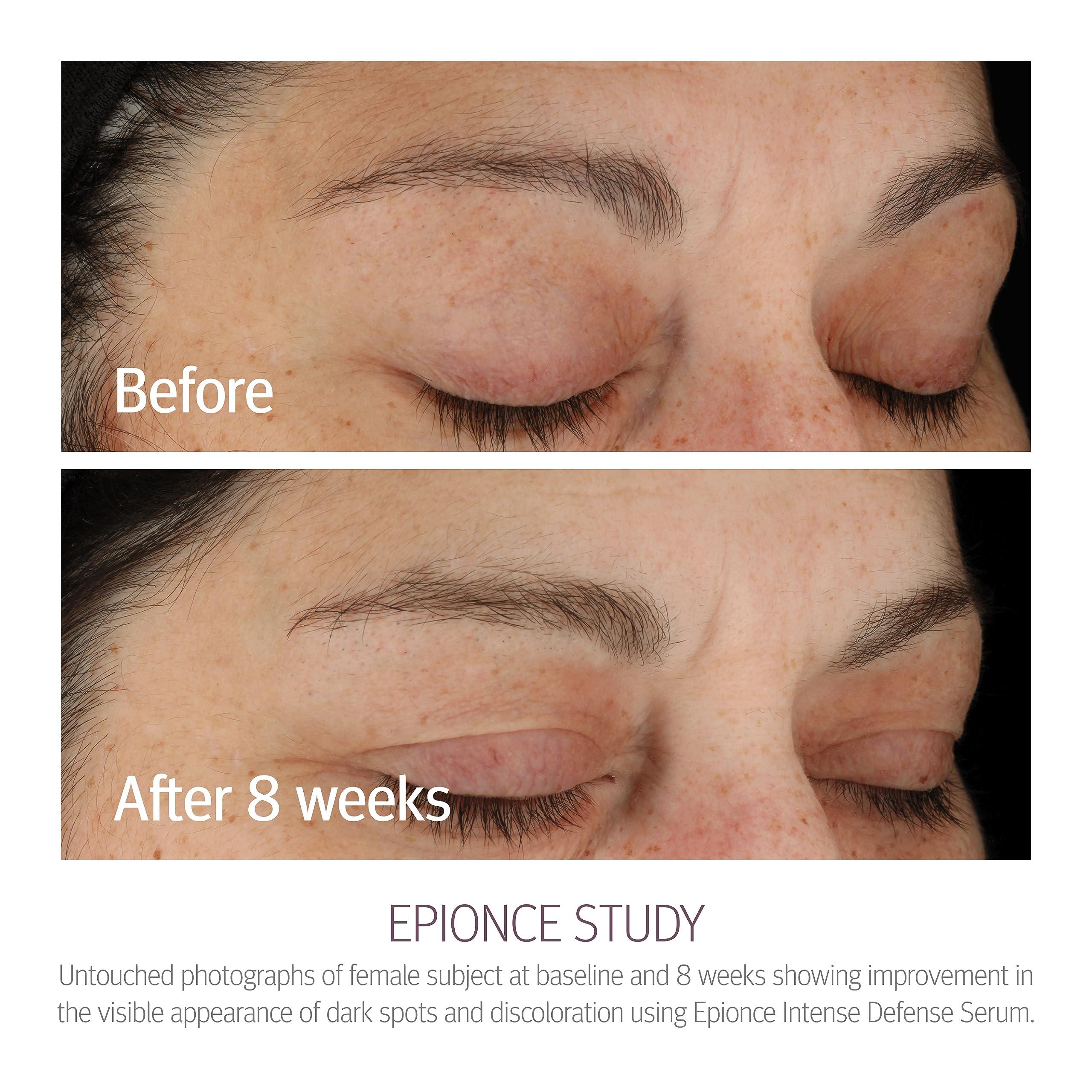 Epionce Epionce Intense Defense Serum - Anti-Aging Facial Serum with Vitamin C, Vitamin E, Vitamin D, A, B, & Niacinamide, Dermatologist Skincare