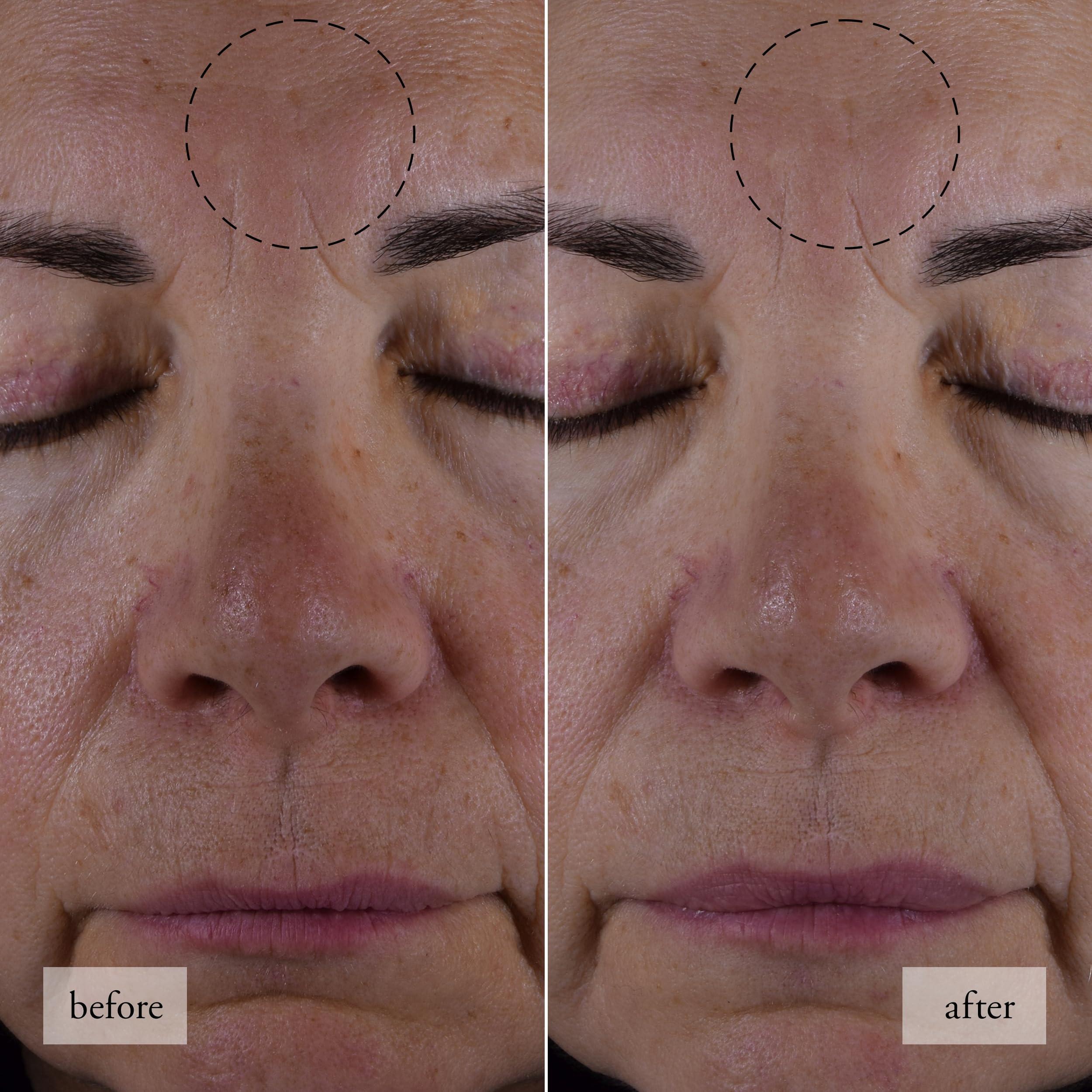 philosophy philosophy hope in a jar smooth-glow multi-tasking moisturizer, 0.5 Fl Oz (Pack of 1)