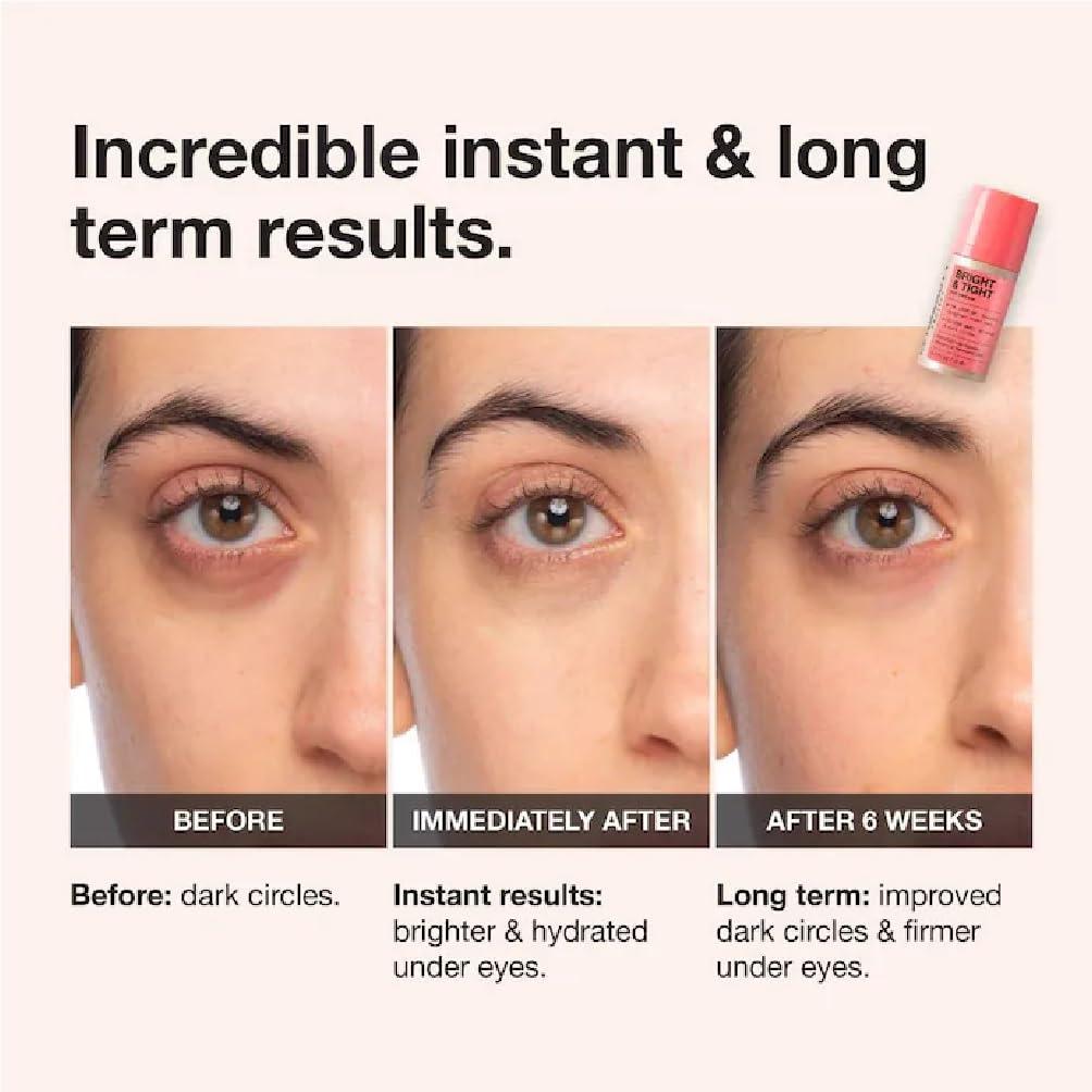 NAPH NAPH iNNBEAUTY PROJECT Bright & Tight Dark Circle Firming Eye Cream with Vitamin C & Peptides (0.5 oz / 15 mL) + Bonus Acne Patch (36 Pieces)