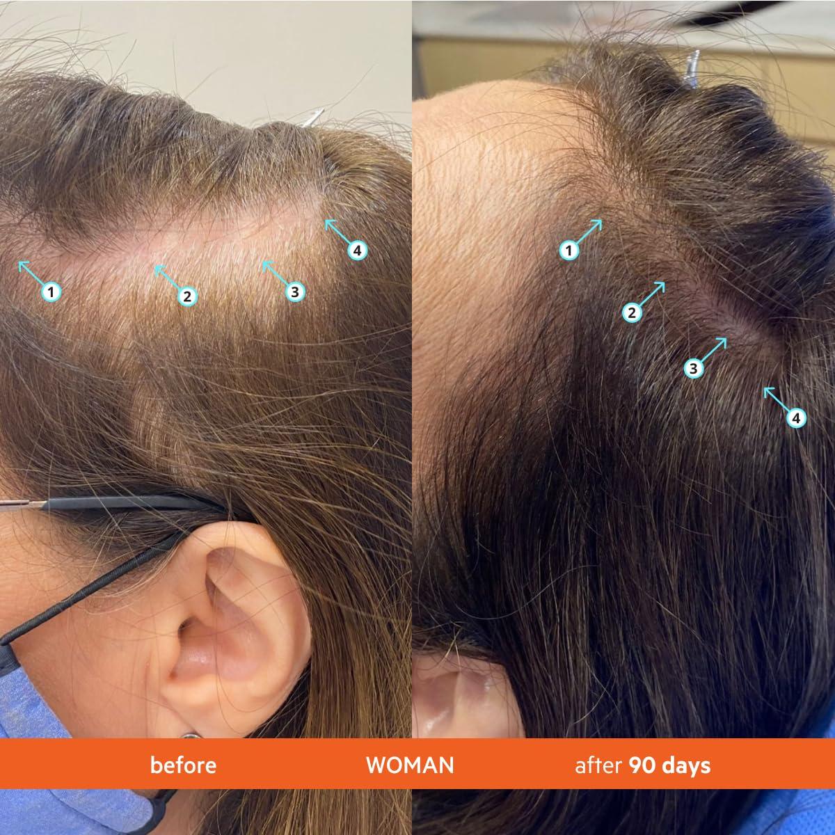 DS LABORATORIES DS Laboratories Revita Shampoo - Hair Growth Shampoo, DHT Blocker, Biotin Formula, for Hair Thickening and Regrowth Treatment for Women and Men