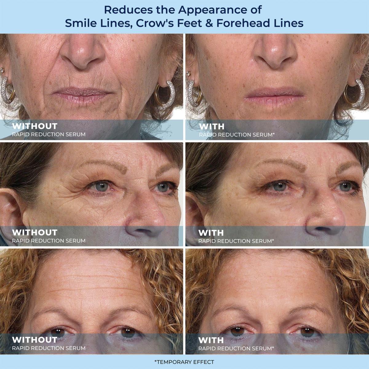 NinthAvenue Basics Plexa derm Rapid Reduction Wrinkle Serum - Reduces Under-Eye Bags, Wrinkles, Dark Circles, Fine Lines & Crow's Feet Instantly (2-Pack)