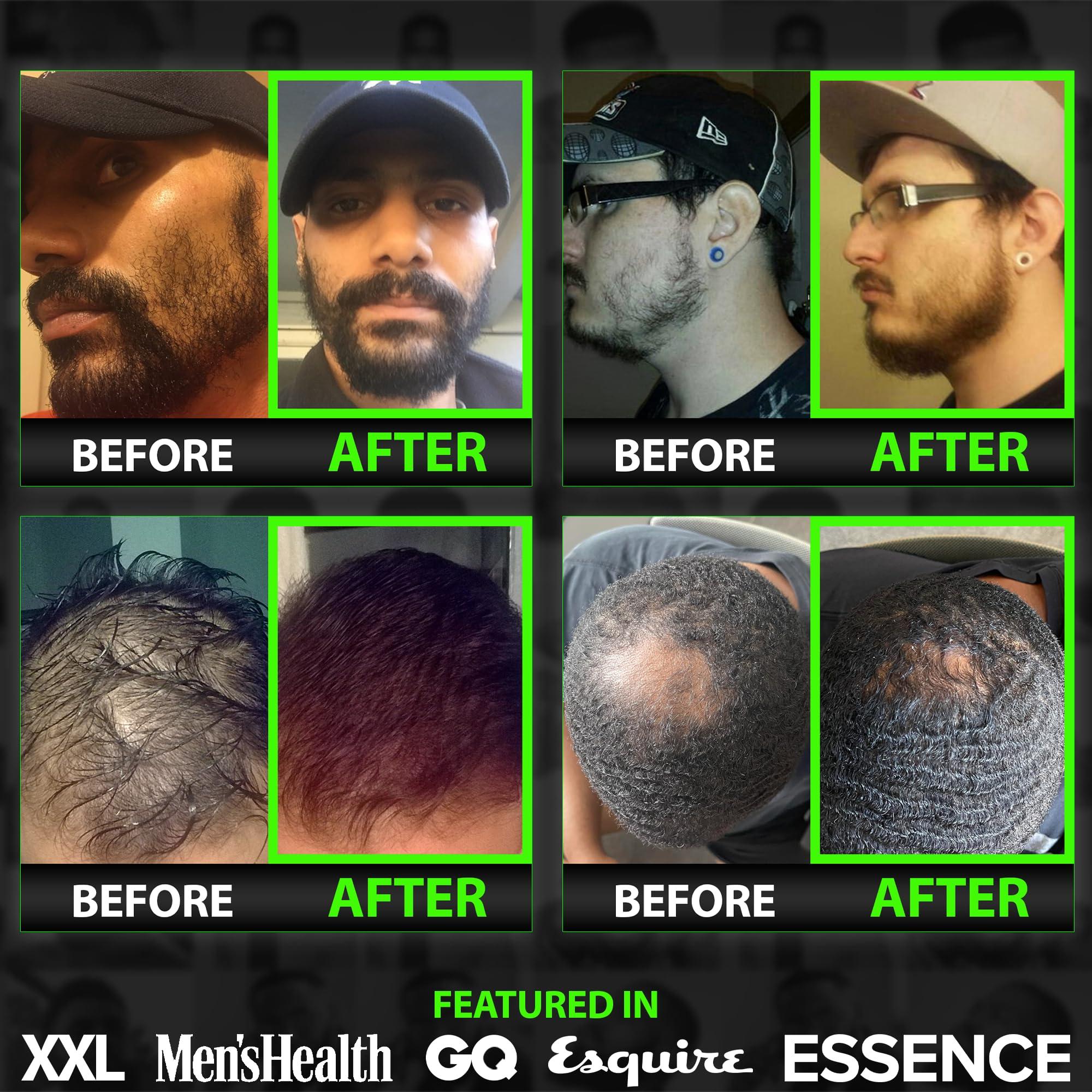 BBS BEST BEARD STUFF Beard Growth Kit w/GROW Beard Oil for Men (Beard Growth Oil for Men, Beard Conditioner) + GROW Hair & Beard Shampoo (11-in-1 Biotin Shampoo for Men)