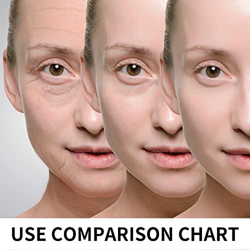 HYPOD HYPOD Pdo Multi Threads, Pdo Lifting Thread Promotes Blood Circulation, 23G38MM, 16 PCS